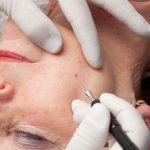Behandlung'12-022